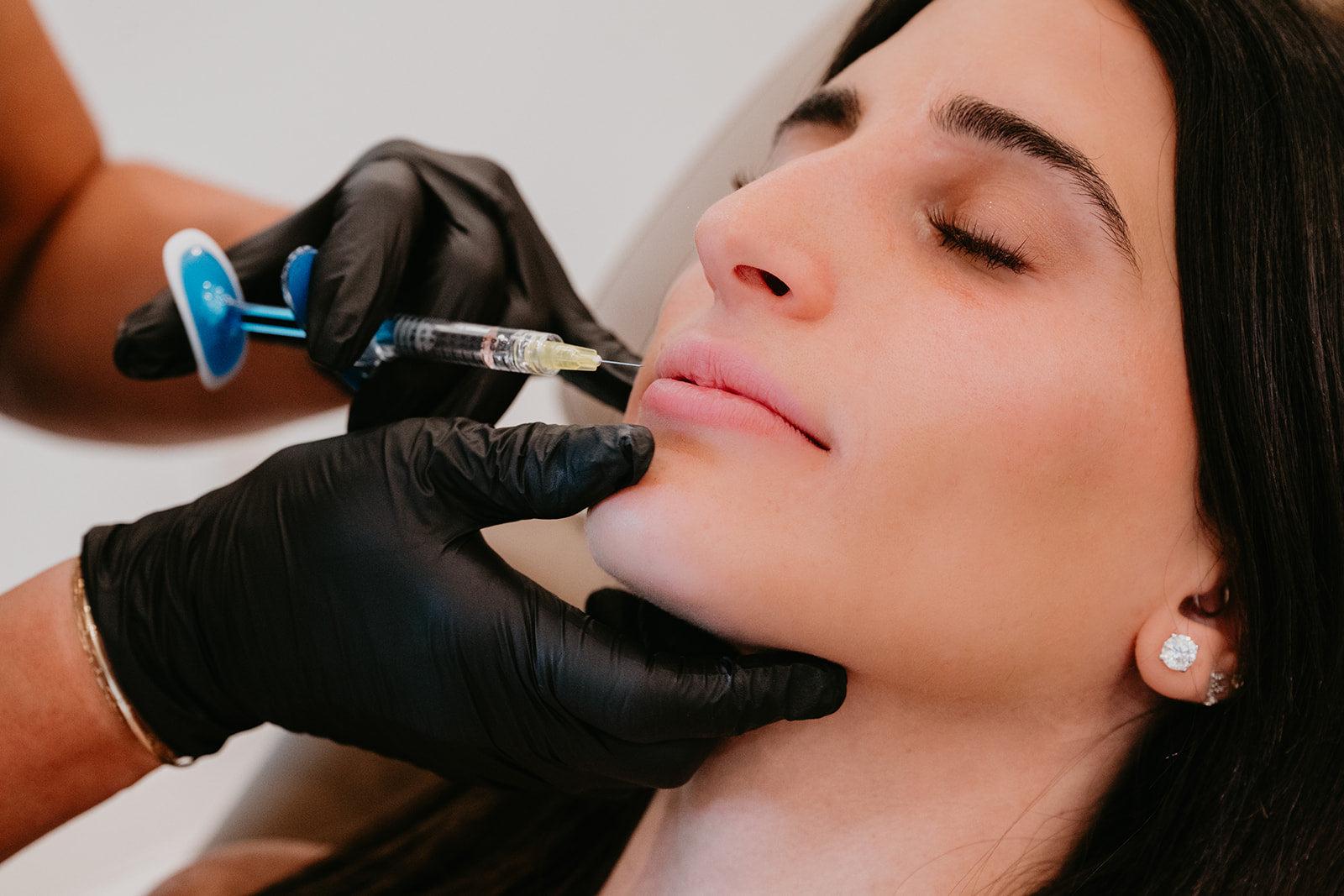 Patient receiving lip injection by medical professional